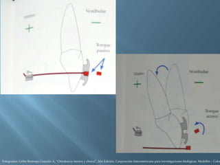 Fotografías: Uribe Restrepo Gonzalo A, “Ortodoncia teorica y clinica”, 2da Edición, Corporación Interamericana para investigaciones biológicas, Medellín – Colom
 