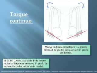 Torque
continuo
Mueve en forma simultanea y la misma
cantidad de grados las raíces de un grupo
de dientes.
EFECTO CARROZA: cada 4° de torque
radicular lingual se aumenta 1° grado de
inclinación de las raíces hacia mesial
Fotografías: Uribe Restrepo Gonzalo A, “Ortodoncia teorica y clinica”, 2da Edición, Corporación Interamericana para investigaciones biológicas, Medellín – Colom
 