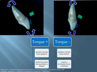 Torque +
alambre torcido
hacia gingival
inclina las raíces
hacia palatino o
lingual
Torque -
alambre torcido
hacia incisal
vamos a
inclinarlas hacia
vestibular
Rodriguez E, “Ortodoncia Contemporanea Diagnóstico y Tratamiento”, México 2da Edición, Amolca, 2008
Fotografía : Rodriguez E, “Ortodoncia Contemporanea Diagnóstico y Tratamiento”,
 