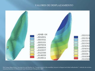 VALORES DE DESPLAZAMIENTO
Wei Liang, Qiguo Rong, Jiuxiang Lin, and Baohua Xu “Torque control of the maxillary incisors in lingual and labial orthodontics”, Artículo de revision,
American Journal of Orthodontics and Dentofacial Orthopedics, 2009
 