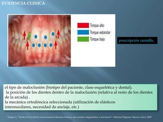 EVIDENCIA CLINICA
prescripción variable.
el tipo de maloclusión (biotipo del paciente, clase esquelética y dental).
la posición de los dientes dentro de la maloclusión (relativa al resto de los dientes
de la arcada) .
la mecánica ortodóncica seleccionada (utilización de elásticos
intermaxilares, necesidad de anclaje, etc.)
Nappa A, “Desde el Arco Recto convencional al Sistema Damon, mis caminos diagnósticos y mecánicos”, Editorial Rippano, Buenos Aires, 2009
 