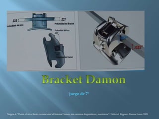 juego de 7°
Nappa A, “Desde el Arco Recto convencional al Sistema Damon, mis caminos diagnósticos y mecánicos”, Editorial Rippano, Buenos Aires, 2009
 
