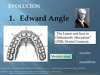 EVOLUCION

“The

Latest and best in
Orthodontic Mecanism”
(1928, Dental Cosmos).

Modelo ideal

maxilar
mandíbula

Angle, ...
