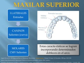 Para que sirven las dobleces finales en los arcos ortodóncicos o colitas? -  Dental Cuba