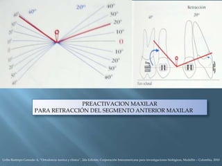 Lectura de dobleces de tip

Uribe Restrepo Gonzalo A, “Ortodoncia teorica y clinica”, 2da Edición, Corporación Interameric...