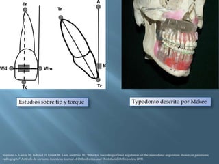 Concluimos que:

mayores
diferencias

Segundas
diferencias

No
diferencias

• paralelismo
radicular en
dientes
adyacentes
...
