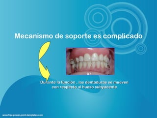Mecanismo de soporte es complicado




      Durante la función , las dentaduras se mueven
           con respecto al hueso subyacente
 