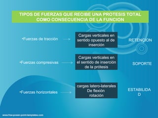 TIPOS DE FUERZAS QUE RECIBE UNA PROTESIS TOTAL
       COMO CONSECUENCIA DE LA FUNCION


                         Cargas verticales en
 •Fuerzas de tracción   sentido opuesto al de     RETENCION
                              inserción


                         Cargas verticales en
•Fuerzas compresivas    el sentido de inserción     SOPORTE
                             de la prótesis



                        cargas latero-laterales
                             De flexión           ESTABILIDA
•Fuerzas horizontales
                               rotación               D
 