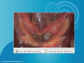 Biomecanica en protesis total dental