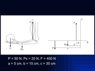 P = 50 N, Ps = 20 N, F = 400 N a = 5 cm, b = 15 cm, c = 30 cm 