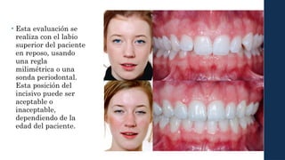 Labio Reposo biomecanica presentacion de tarea biomecanica 3 | PPTX