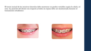 Labio Reposo biomecanica presentacion de tarea biomecanica 3 | PPTX