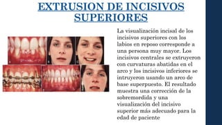 Labio Reposo biomecanica presentacion de tarea biomecanica 3 | PPTX