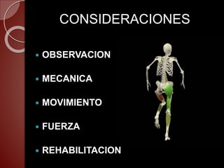 CONSIDERACIONES
OBSERVACION
MECANICA
MOVIMIENTO
FUERZA
REHABILITACION