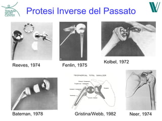 Prothese Inverser Biomeccanica protesi inversa | PPT