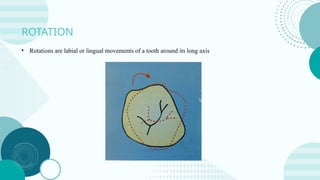 BIOMECHANICS IN ORTHODONTICS TREATMENTS | PPTX