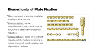 Comprehensive Biomechanics of Fractures and Fixation Techniques in ...
