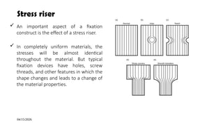 Stress Riser Table Comprehensive Biomechanics of Fractures and Fixation Techniques in ...