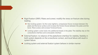 Semi Rigid Fixation Examples Biomechanical & Basic Principles CMF Osteosynthesis.pptx