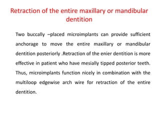 Retraction of the entire maxillary or mandibular
dentition
Two buccally –placed microimplants can provide sufficient
anchorage to move the entire maxillary or mandibular
dentition posteriorly .Retraction of the enier dentition is more
effective in patient who have mesially tipped posterior teeth.
Thus, microimplants function nicely in combination with the
multiloop edgewise arch wire for retraction of the entire
dentition.
 