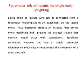 Retromolar microimplants for single molar
uprighting
Elastic chain or ligature wire can be connected from a
retromolar microimplant to an attachment on the tipped
molar. These mechanics produce an intrusive force during
molar uprighting and prevent the occlusal trauma that
normaly would occur with conventional uprighting
techniques. However, this type of simple retromolar
microimplant mechanics cannot control the movement of a
tooth precisely.
 