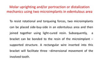 Molar uprighting and/or portraction or distalization
mechanics using two microimplants in edentulous area
To resist rotational and torqueing forces, two microimplants
can be placed side-buy-side in an edentulous area and then
joined together using light-cured resin. Subsequently, a
bracket can be bonded to the resin of the microimplant –
supported structure. A rectangular wire inserted into this
bracket will facilitate three –dimensional movement of the
involved tooth.
 