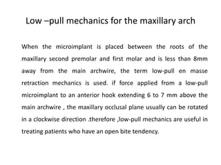 Low –pull mechanics for the maxillary arch
When the microimplant is placed between the roots of the
maxillary second premolar and first molar and is less than 8mm
away from the main archwire, the term low-pull en masse
retraction mechanics is used. if force applied from a low-pull
microimplant to an anterior hook extending 6 to 7 mm above the
main archwire , the maxillary occlusal plane usually can be rotated
in a clockwise direction .therefore ,low-pull mechanics are useful in
treating patients who have an open bite tendency.
 