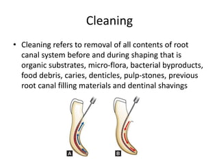 Cleaning
• Cleaning refers to removal of all contents of root
canal system before and during shaping that is
organic substrates, micro-flora, bacterial byproducts,
food debris, caries, denticles, pulp-stones, previous
root canal filling materials and dentinal shavings
 
