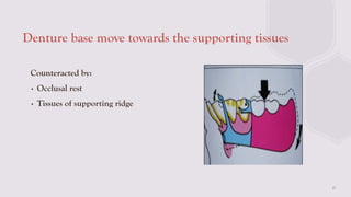Titanium Base Rpd BIOMECHANICAL PRINCIPALS IN RPD IN PROSTHODONTICCS | PPTX