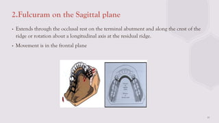Sadgital Ridge BIOMECHANICAL PRINCIPALS IN RPD IN PROSTHODONTICCS | PPTX