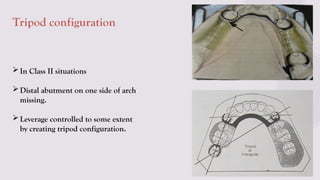 BIOMECHANICAL PRINCIPALS IN RPD IN PROSTHODONTICCS | PPTX