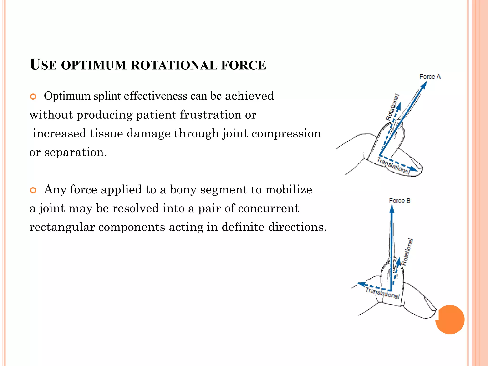 Biomechanical principle of hand splining | PDF