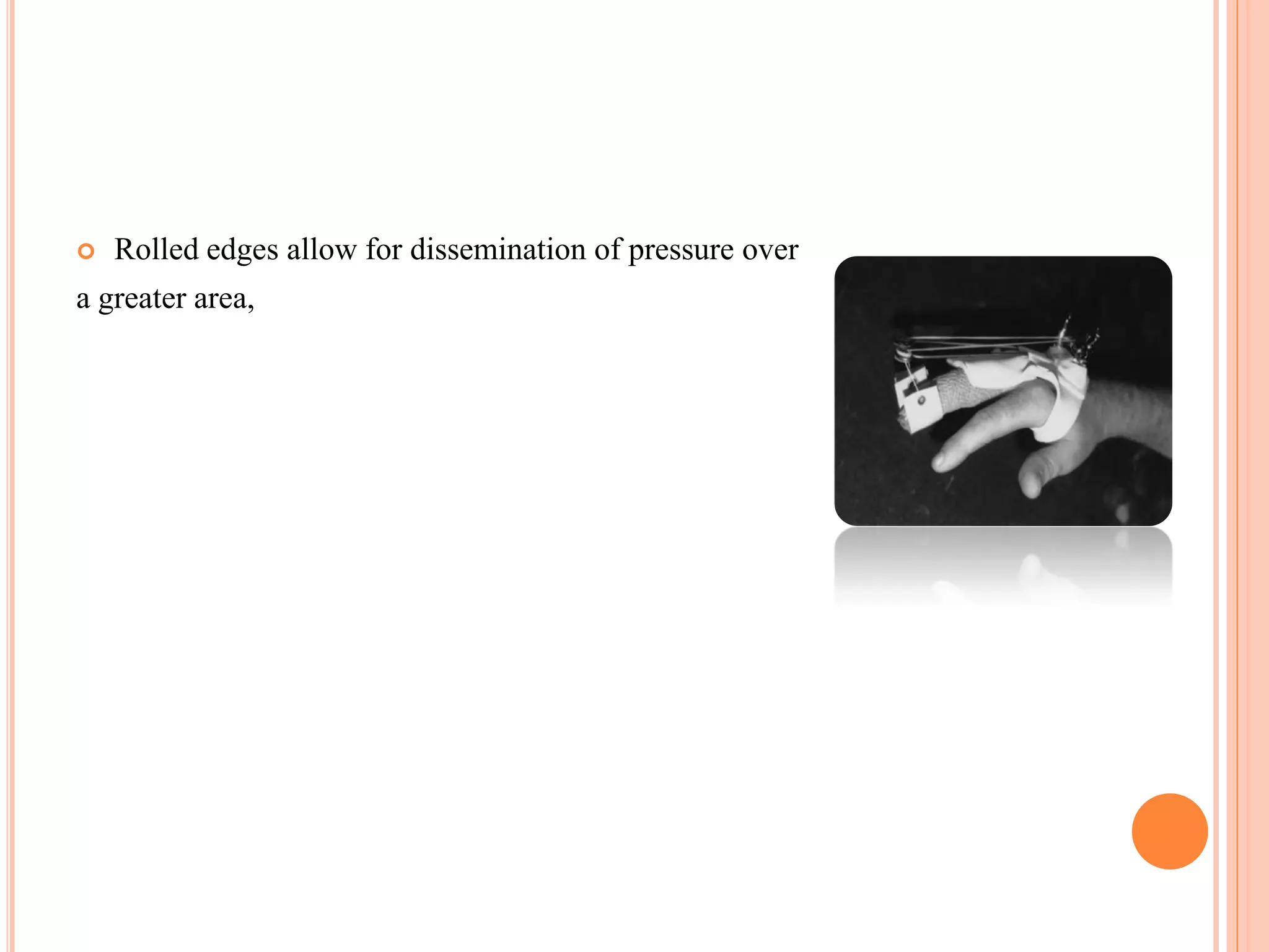 Biomechanical principle of hand splining | PDF