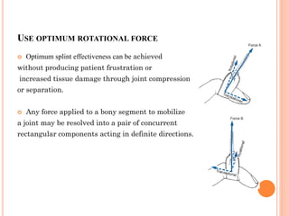 Biomechanical principle of hand splining | PDF