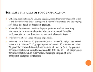 Biomechanical principle of hand splining | PDF