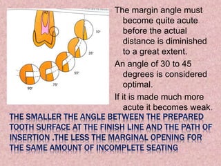 Marginal Opening Biomechanical principles of TOOTH PREPARATION | PPTX