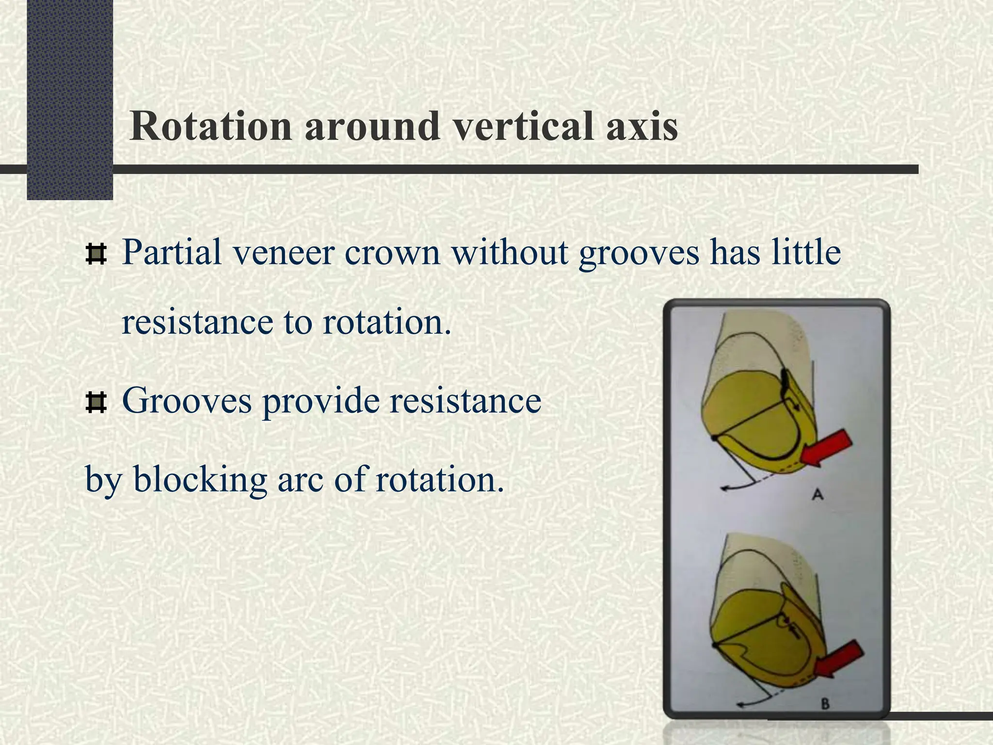 Visual Blocking Neck Rotation Biomechanical Principles of Tooth Preparation in FPD.ppt