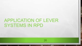 Lever System Rpd Biomechanical problems associated with free end saddle dentures | PPTX