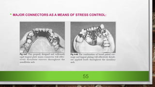 • MAJOR CONNECTORS AS A MEANS OF STRESS CONTROL:
55
 