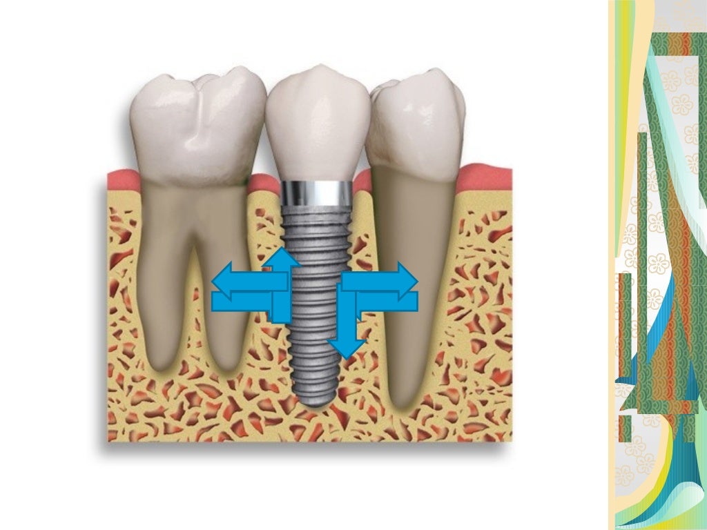 Biomechanics/ orthodontics australia