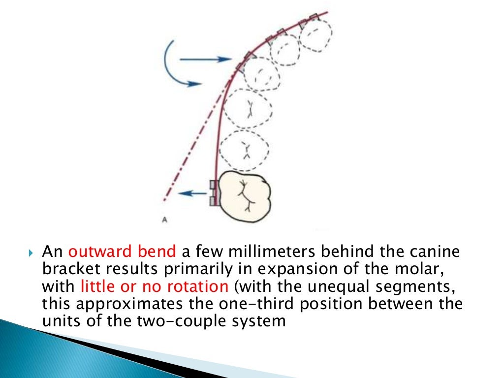 Orthodontic Biomechanics