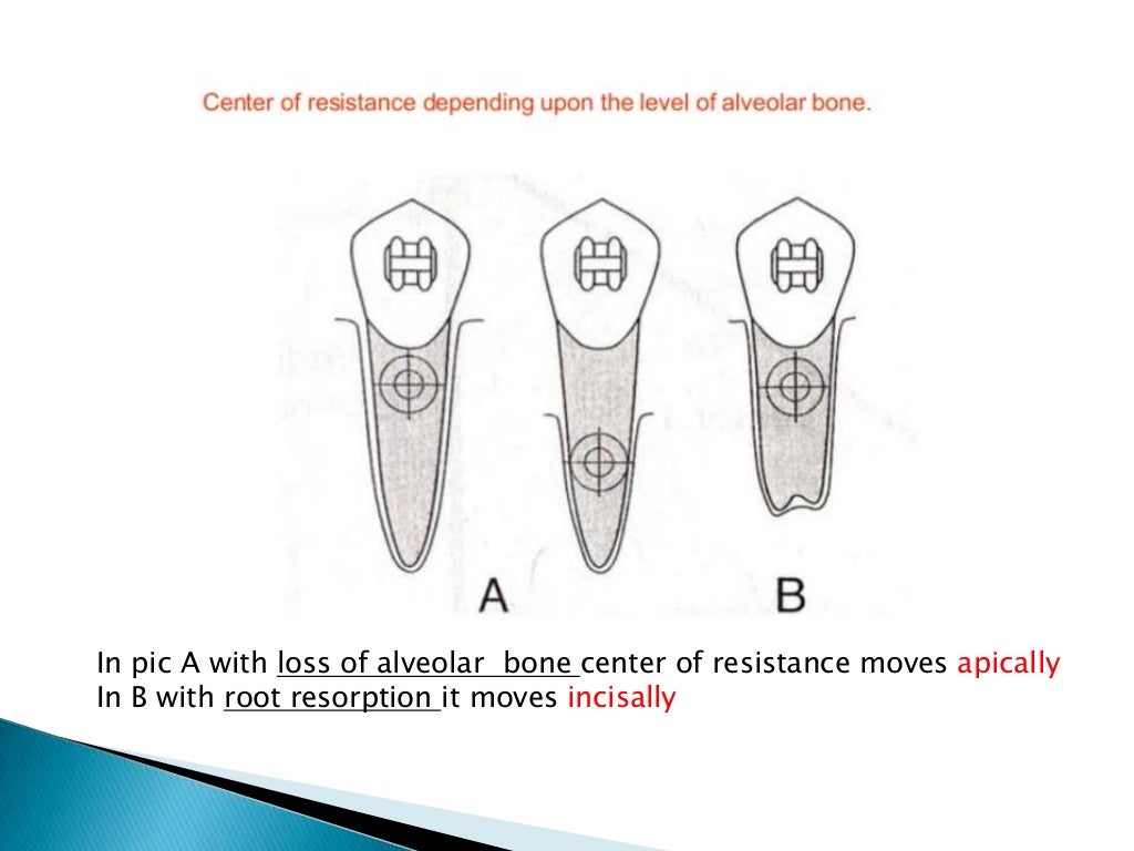 Orthodontic Biomechanics