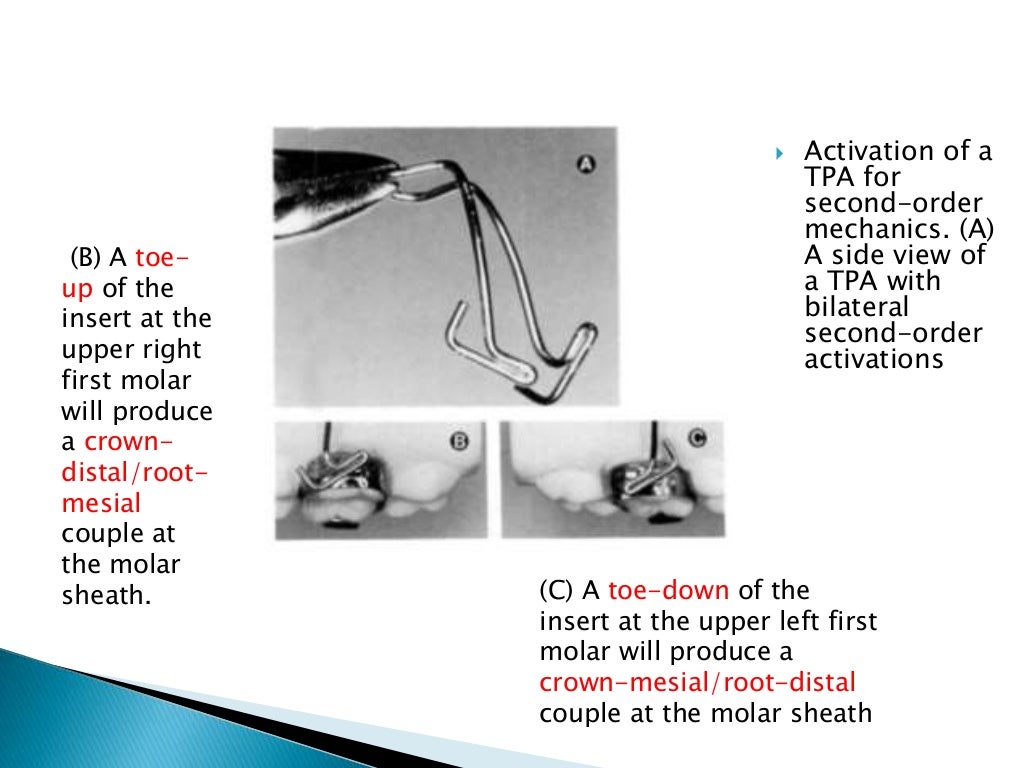 Orthodontic Biomechanics