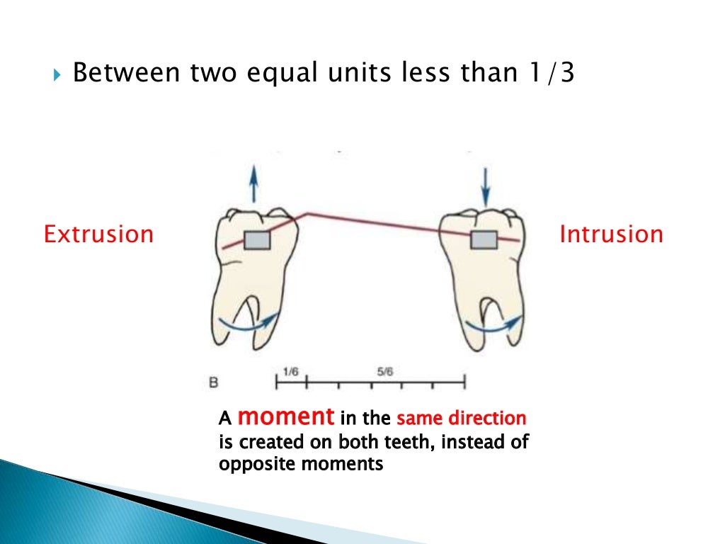 Orthodontic Biomechanics