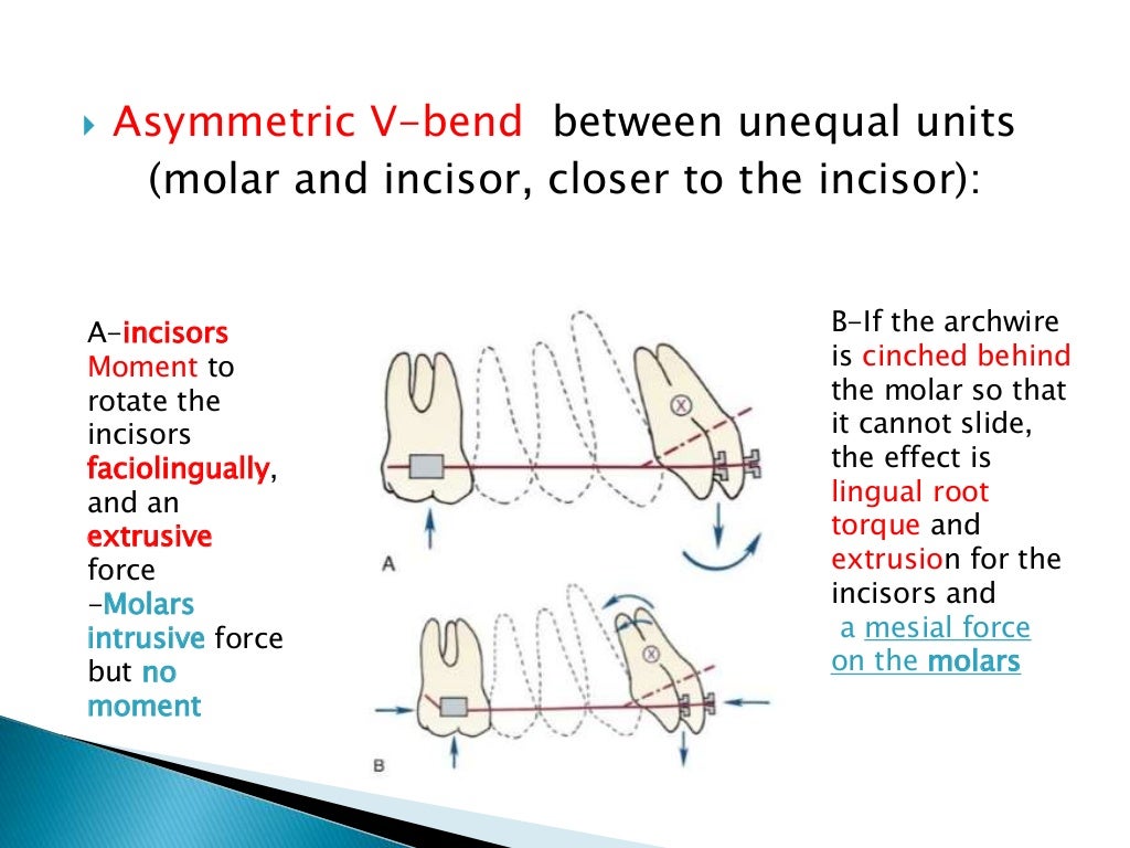 Orthodontic Biomechanics