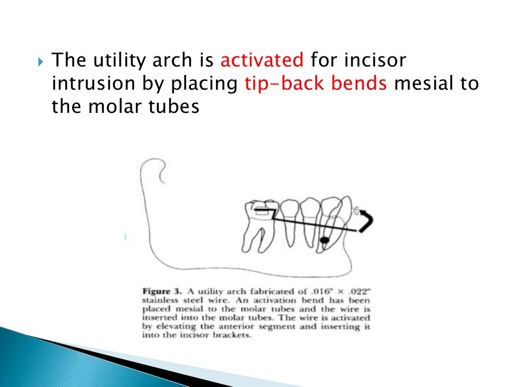 Orthodontic Biomechanics