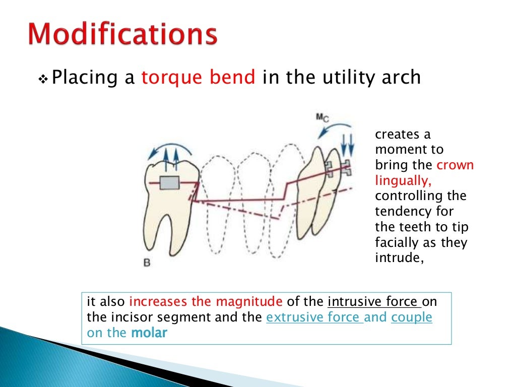 Orthodontic Biomechanics