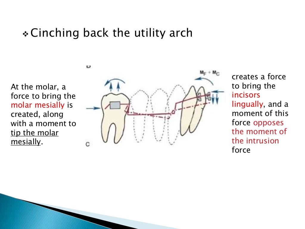 Orthodontic Biomechanics