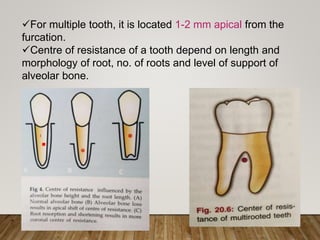 Biomechanics in Orthodontic tooth movements | PPTX