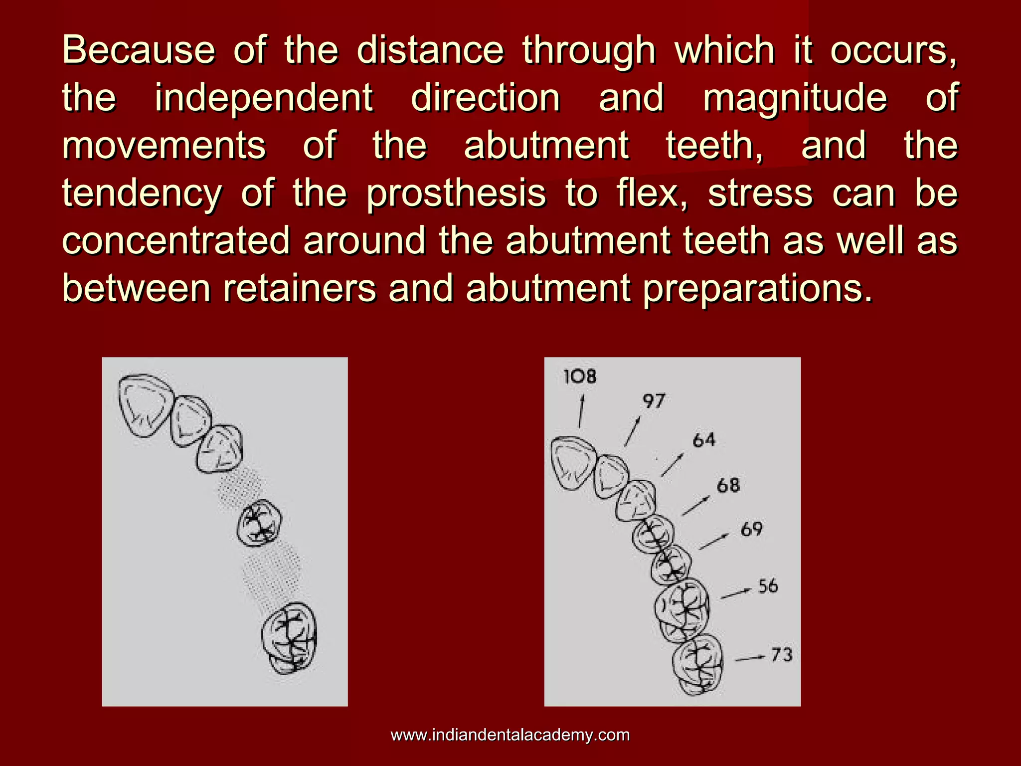 Because of the distance through which it occurs,
the independent direction and magnitude of
movements of the abutment teeth, and the
tendency of the prosthesis to flex, stress can be
concentrated around the abutment teeth as well as
between retainers and abutment preparations.

www.indiandentalacademy.com

 